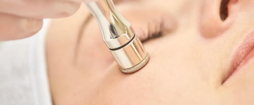 Microdermabrasion wand on a client's cheek