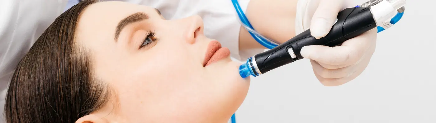 Microneedling device being used on a client's chin