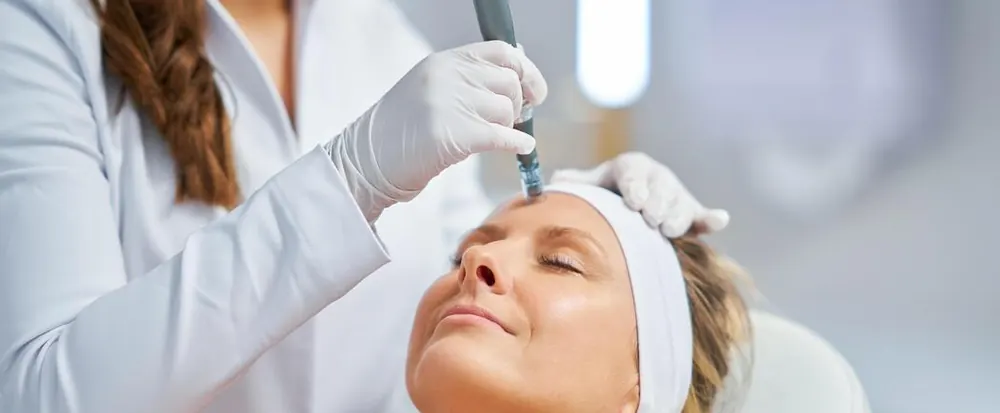Provider performing a microneedling treatment