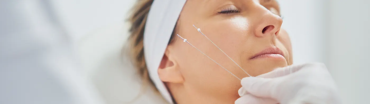 Provider placing PDO threads along a client's cheek