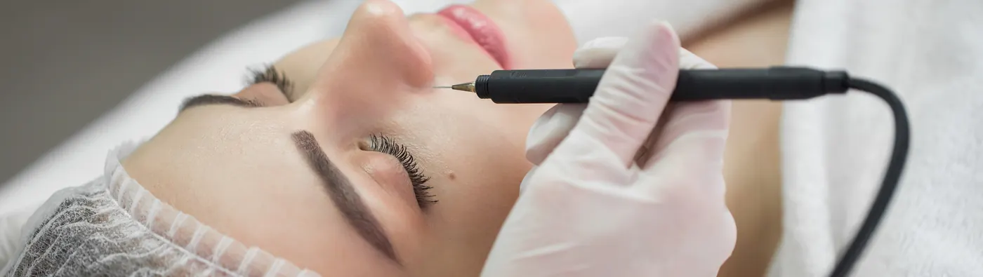 Provider using a plasma pen near a client's eye