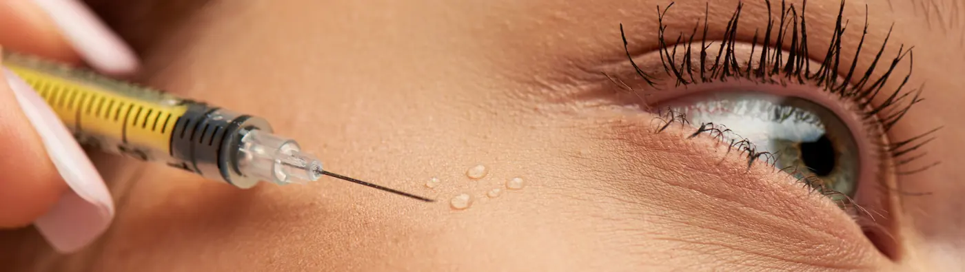 Close-up of a PRF injection beneath the eye