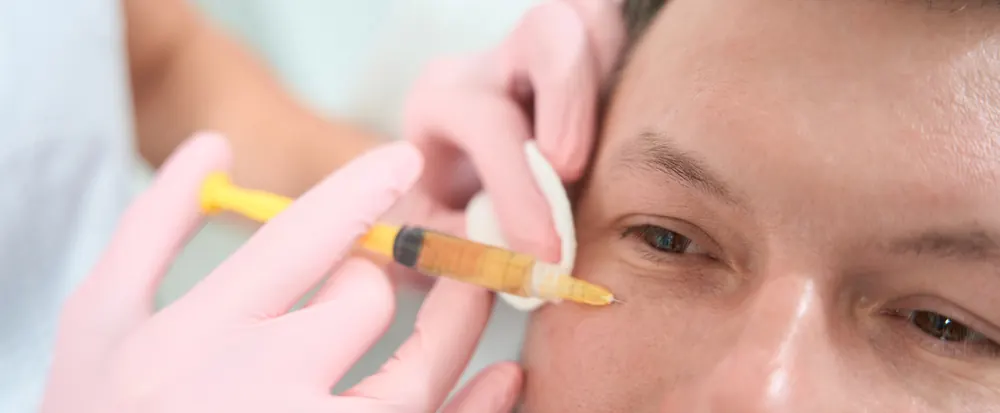 PRF treatment being applied under a client's eye
